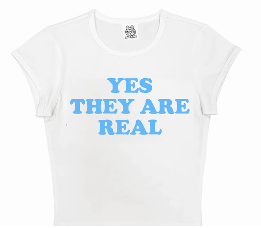Yes They Are Real